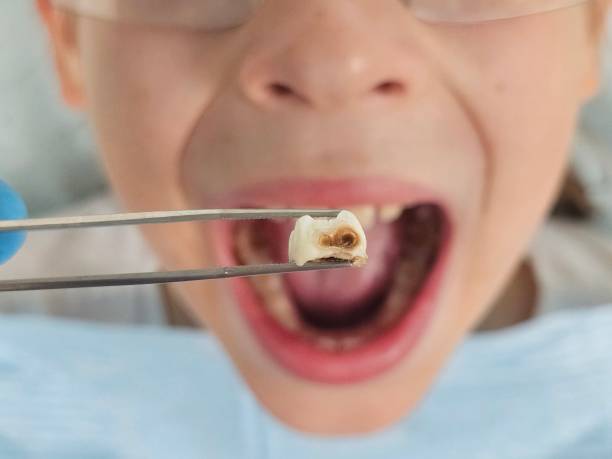 Best Walk-In Emergency Dental Services in Lisle, IL