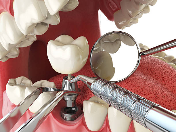 Best Emergency Care for Gum Disease in Lisle, IL